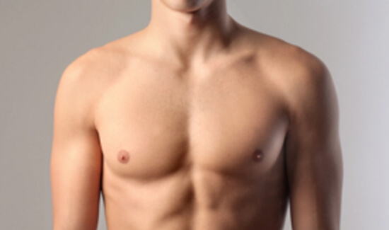 Picture of a man showing his chest and happy with his perfect male breast reduction procedure he had with Cabo MedVentures in beautiful San José, Costa Rica.  The man is shirtless and facing the camera and standing against a light purple background.