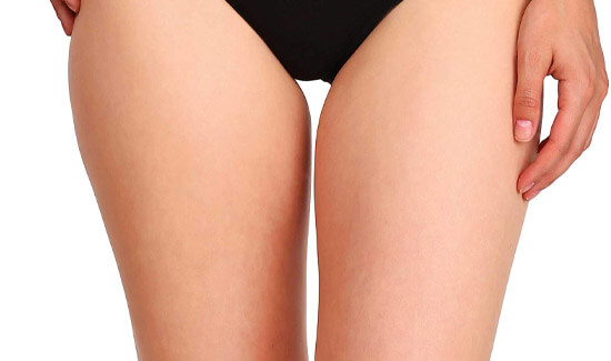 Picture of a trim woman wearing a black bikini bottom, and happy with her perfect thigh lift she had with Costa Rica MedVentures in beautiful San José, Costa Rica.  The woman is facing the camera and has both arms down to her sides.