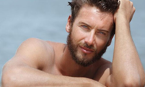 Close-up picture of a man,  happy with his hair transplant  procedure he had in San José, Costa Rica.  The man is shown leaning against the edge of a pool and looking directly at the camera with an arm raised to his head to feature his hair transplant.